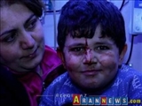 Gəncədə yaralanan uşaq: "Daşın altında qaldım"